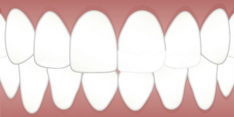Denti medievali