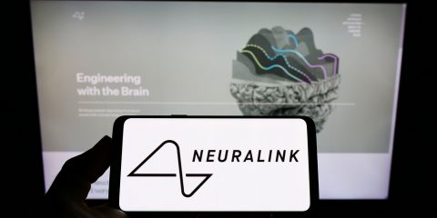 Neuralink ha installato il primo chip nel cervello umano