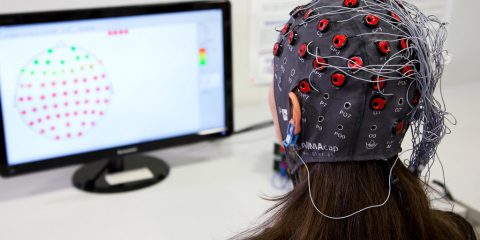 Synchron (rivale di Neuralink) cerca pazienti per un grosso test clinico di chip nel cervello