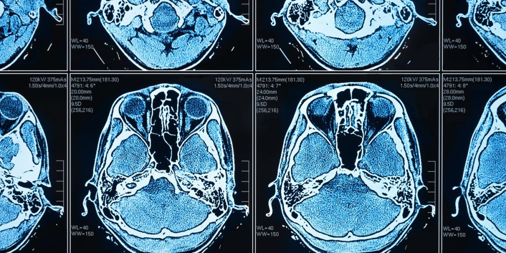 AI nel rapporto di cura del paziente, presentate alla Camera le linee guida Anitec-Assinform